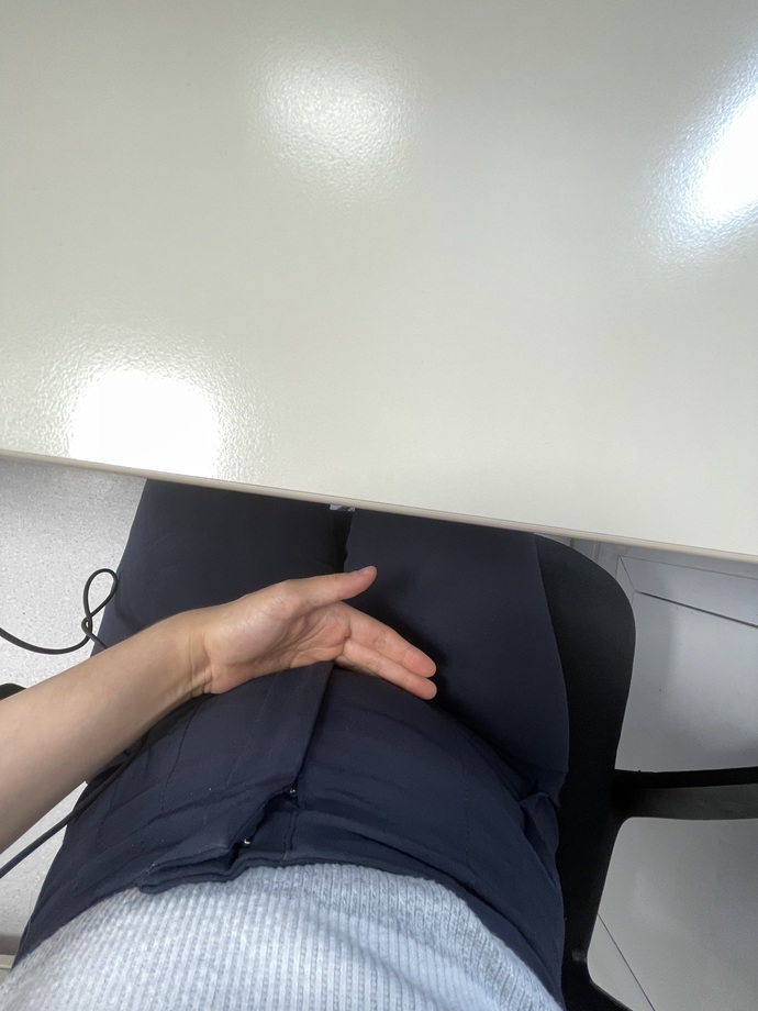 Bu şişlik normal mi kola içtim gastrit var ama yanma oluyı kalbimde kollarımda iğne batması sapıklık etmeyin?