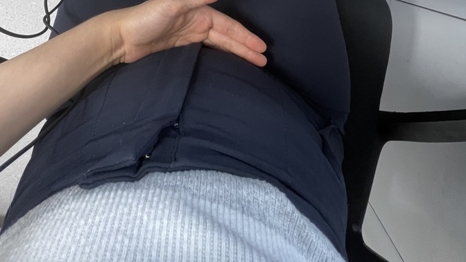 Bu şişlik normal mi kola içtim gastrit var ama yanma oluyı kalbimde kollarımda iğne batması sapıklık etmeyin?