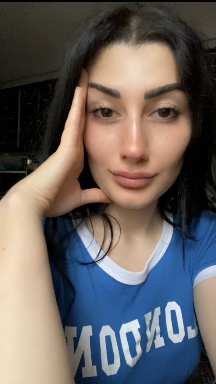 Benim neyim Kylie Jenner’a benziyor 😅?