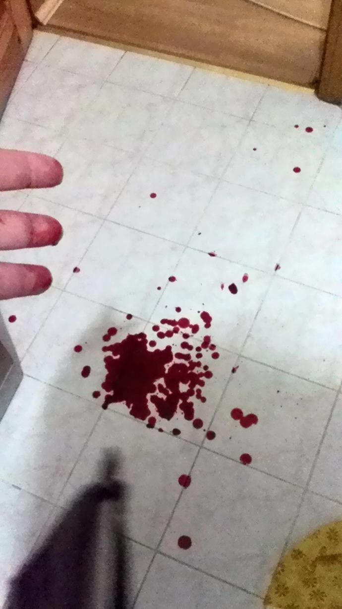 Hiç parmağınız kesildi mi sizin?