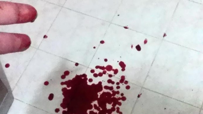 Hiç parmağınız kesildi mi sizin?