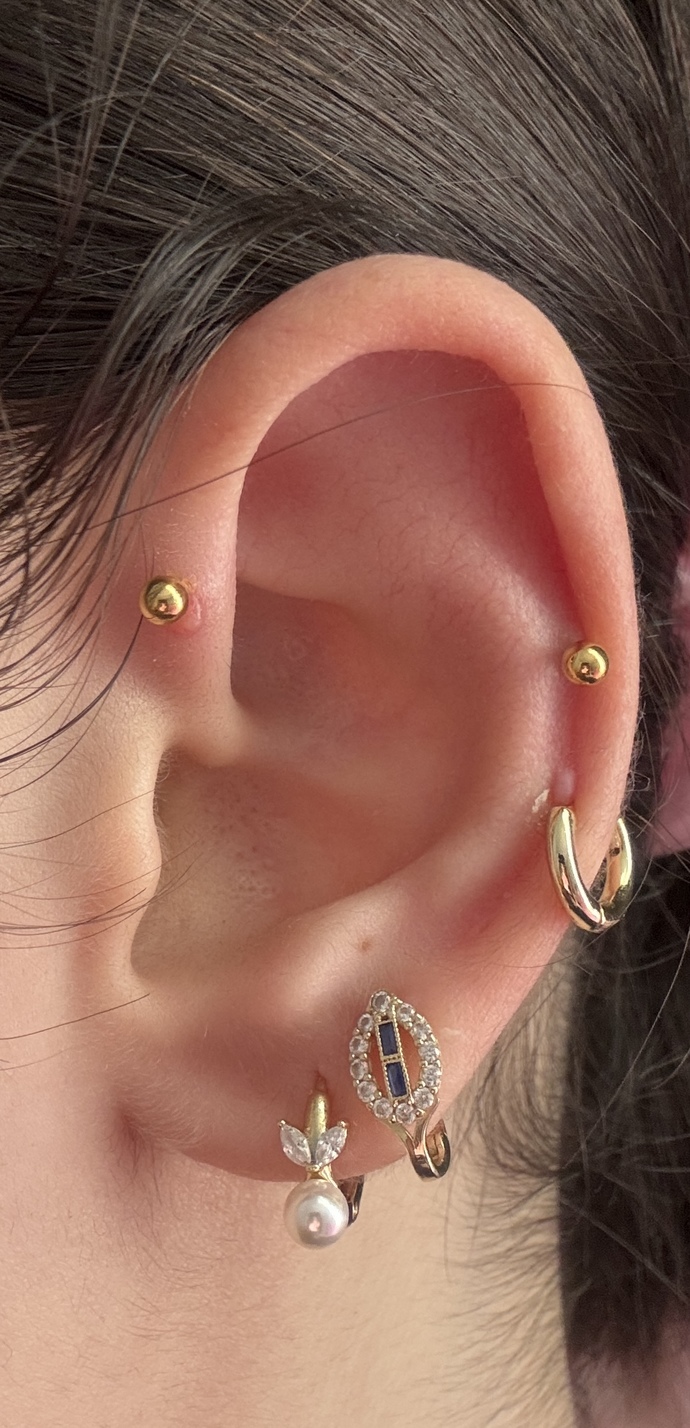 Piercingim de bump çıktı?