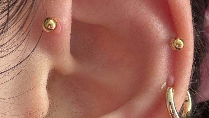 Piercingim de bump çıktı?