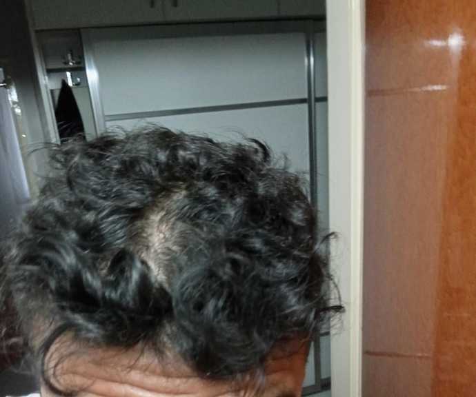 19 yaşındayım saçlarım çok kötü ne yapıcam?