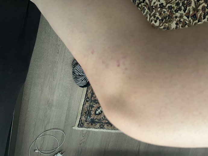 Bacaklarıma ilk defa ağda yaptım ve böyle oldu, neden?