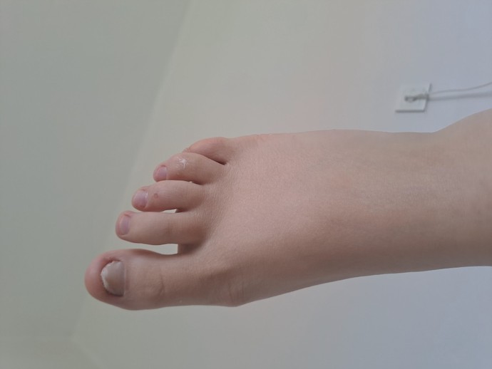 Sizce ayağım çok mu kötü görünüyor?