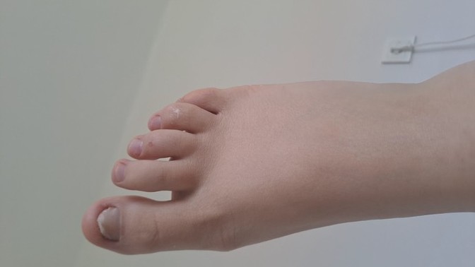 Sizce ayağım çok mu kötü görünüyor?
