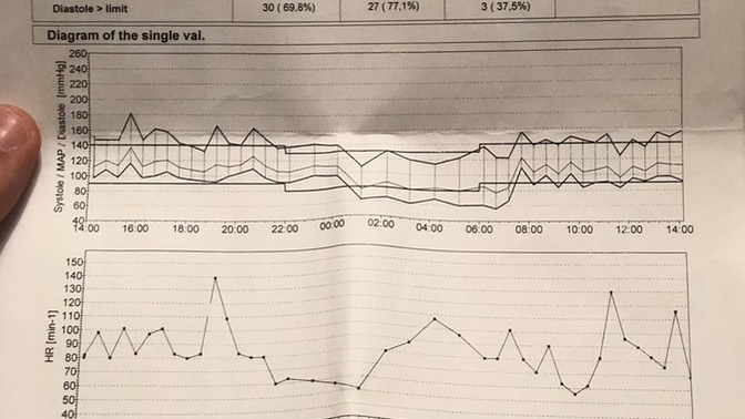 Yaşım daha 30 ve gün içinde iki tane tansiyon ilacı kullanıyorum norvaks ve delix bu tansiyona bu ilaçlar normal mi çok mu?
