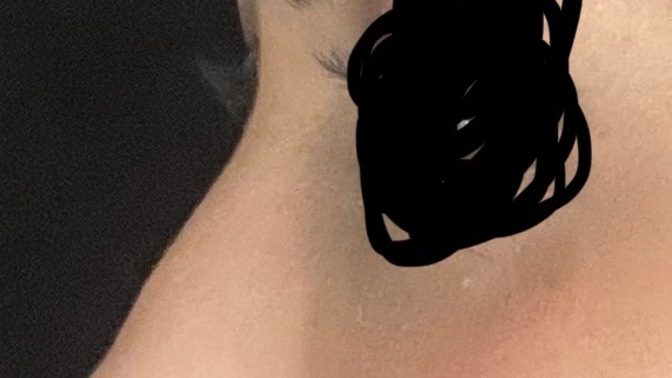 Burun ameliyatı olmustum yine burnum büyüdü kemik çıktı kemerli garip oldu?