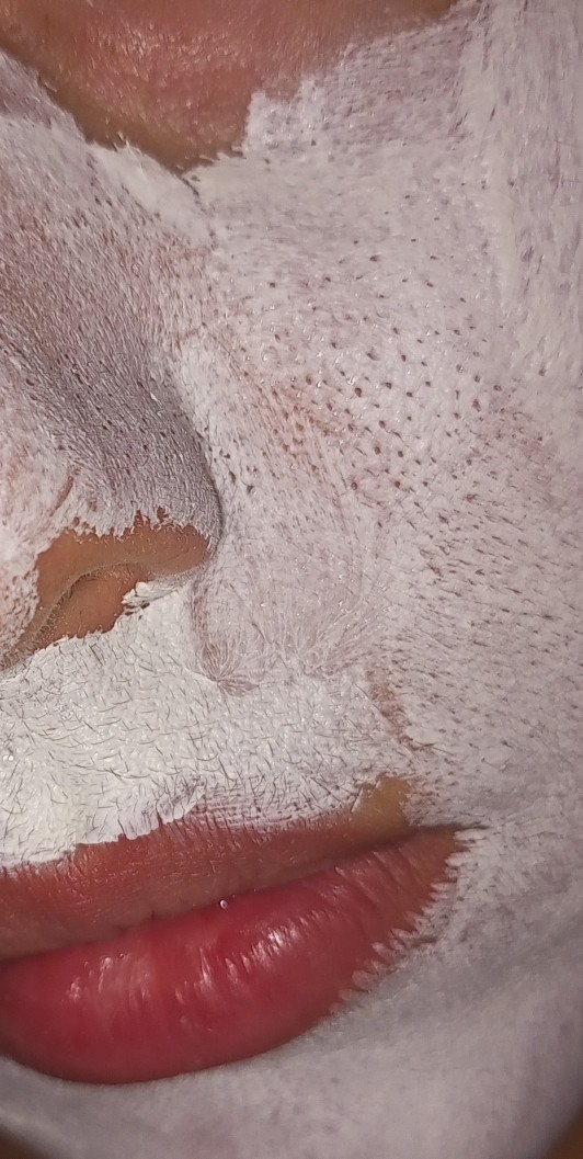 Maske yaptım gözenekler neden belirgenleşti ki şimdi?