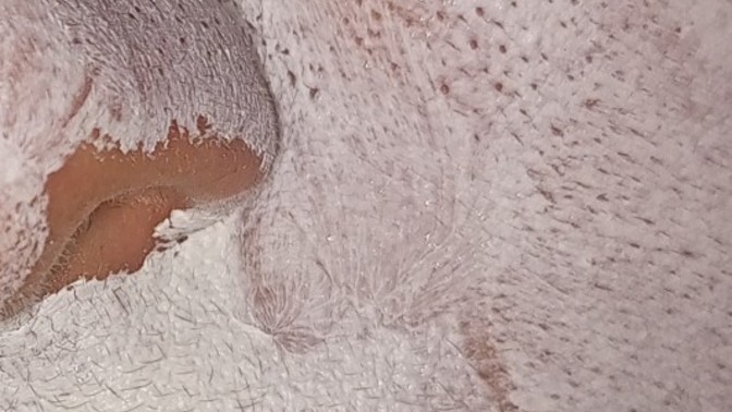 Maske yaptım gözenekler neden belirgenleşti ki şimdi?