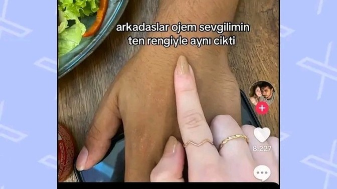 Ten rengi önemli mi?
