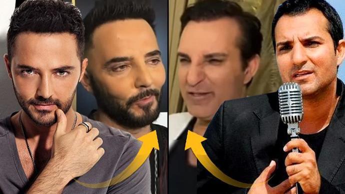 Erkeklerin estetik yaptırması ayıp mı, abes mi?