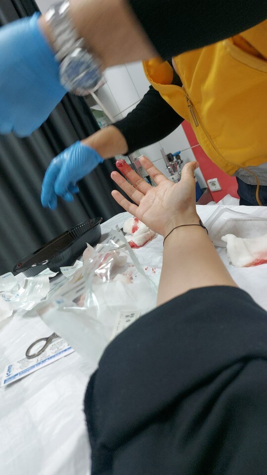 Yaraya müdahale ederdik, bugün müdahale edilen ben olunca garip hissetmem normal mi?