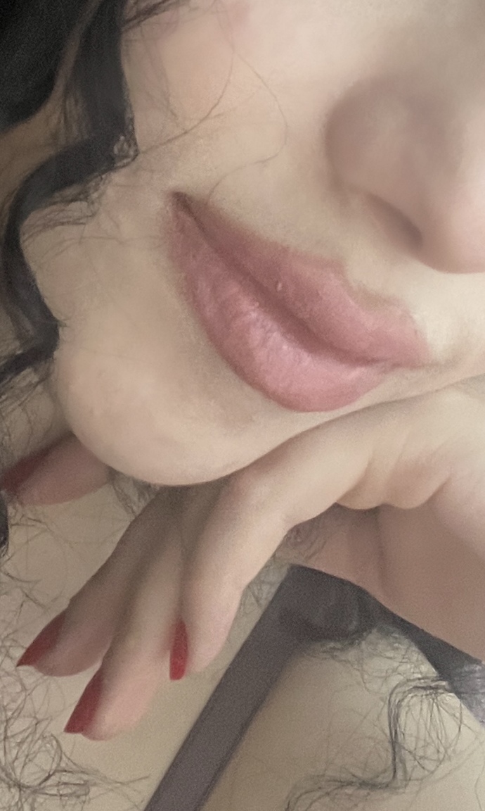 Dudağıma dolgu yaptırdım biraz çok fark olmuş mu?