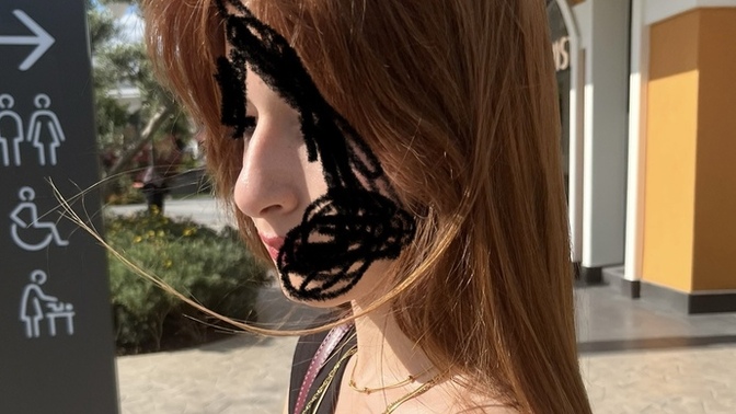Burnum çok kötü mü?