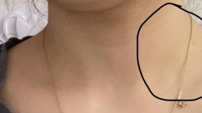 İşaretlediğim kısımda şişlik görebiliyor musunuz? yok bir şey değil mi?