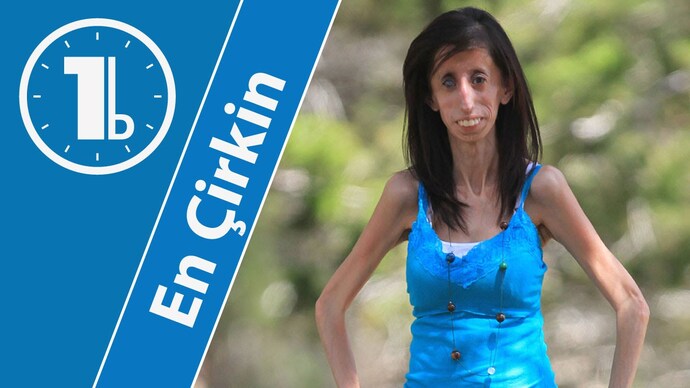 Çok zeki , çok ahlaklı , çok zengin olsa bile böyle bir kızla evlenir misiniz ya da sevgili olur musunuz eyyyy erkek milleti?