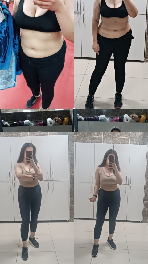 Benim before after nasıl?