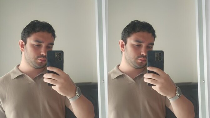 Yüzümdeki yağ çok mu kötü duruyor sizce, kilo vermem gerekir mi?