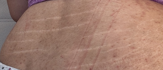 Bikini giyeceğim fakat bu kılları almak şartmı sizce?