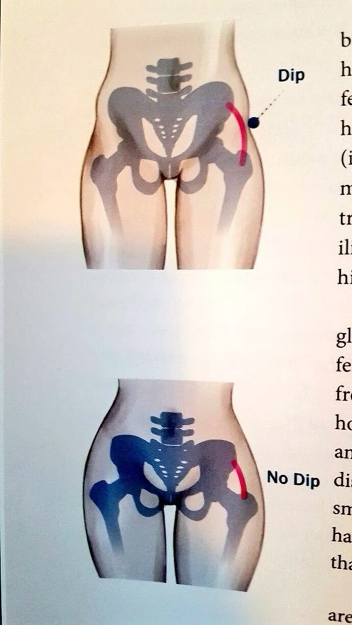 Hip dipsler hakkında ne düşünüyorsunuz?