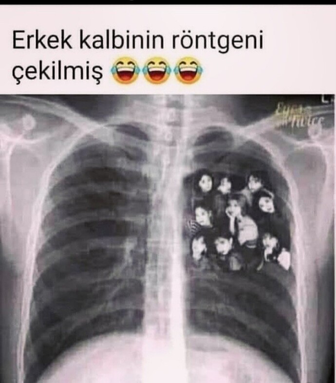 Erkek kalbinin röntgeni çekilmiş katılanlar kimler?