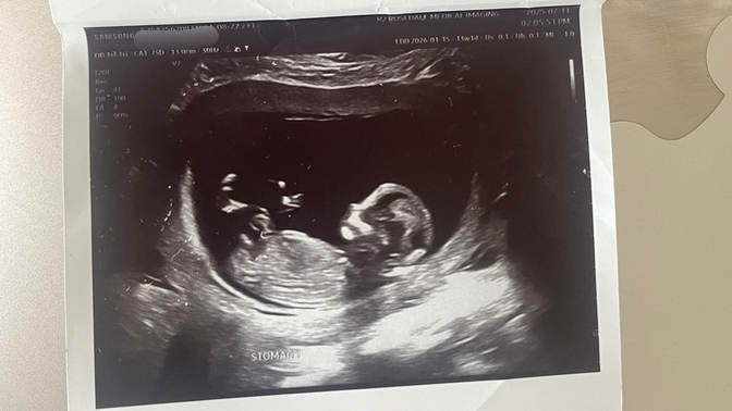 Bu bebek erkek mi kız mı?