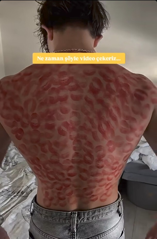 Partnerin vücuduna imza bırakmayı sever misiniz?
