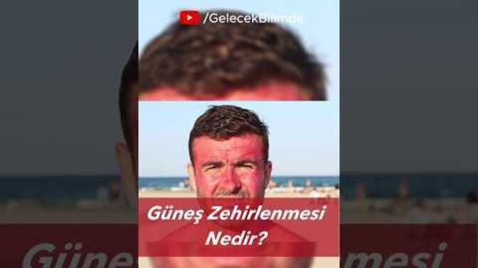 Güneşte Fazla Kalınca Neler Oluyor?