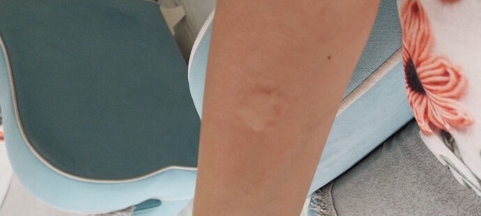 Sizi de sivriler yer mi 🥹?