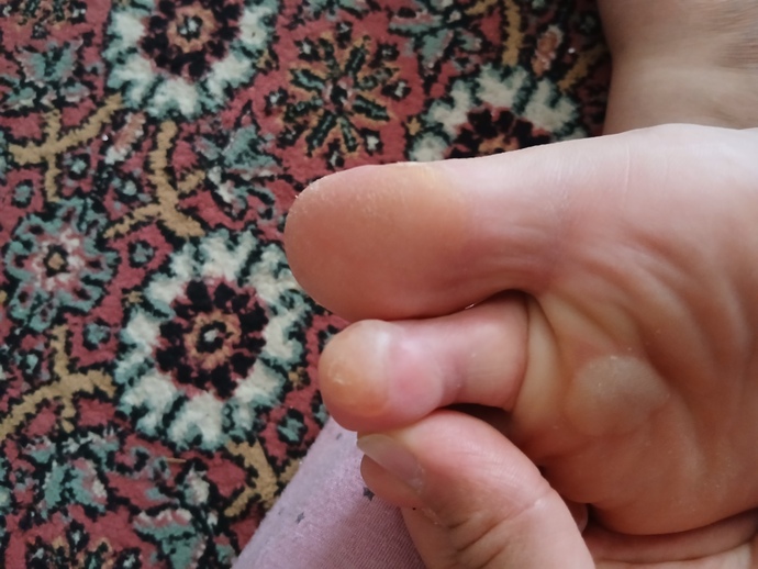 Hastane de calişiyorum. Ayakkabi giymektem ayagım böule oldu iş ayakkabısı şimdi crop tipli bi terlik aldım ayaklar bb şekilde so?