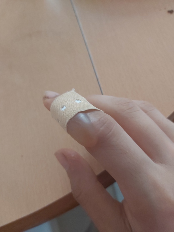 Parmağım çok kötü su topladı ilk başta bu kadar şiş değildi patlatsam daha mı kötü olur?