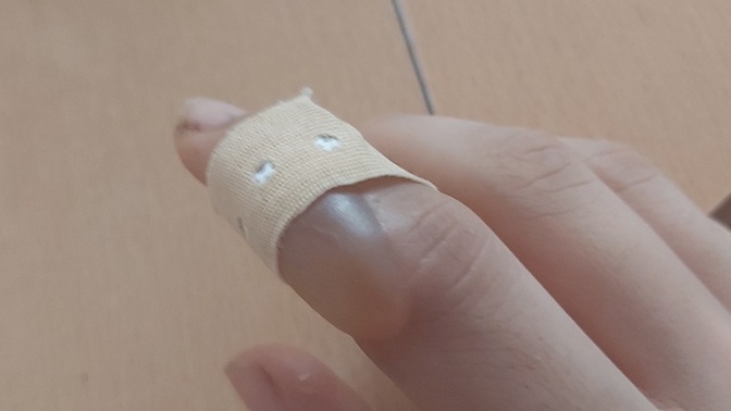 Parmağım çok kötü su topladı ilk başta bu kadar şiş değildi patlatsam daha mı kötü olur?