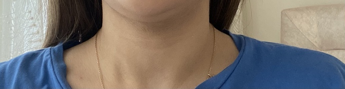 Boynumun bir tarafında ki şişliği görebiliyor musunuz? neden öyle olur ya?