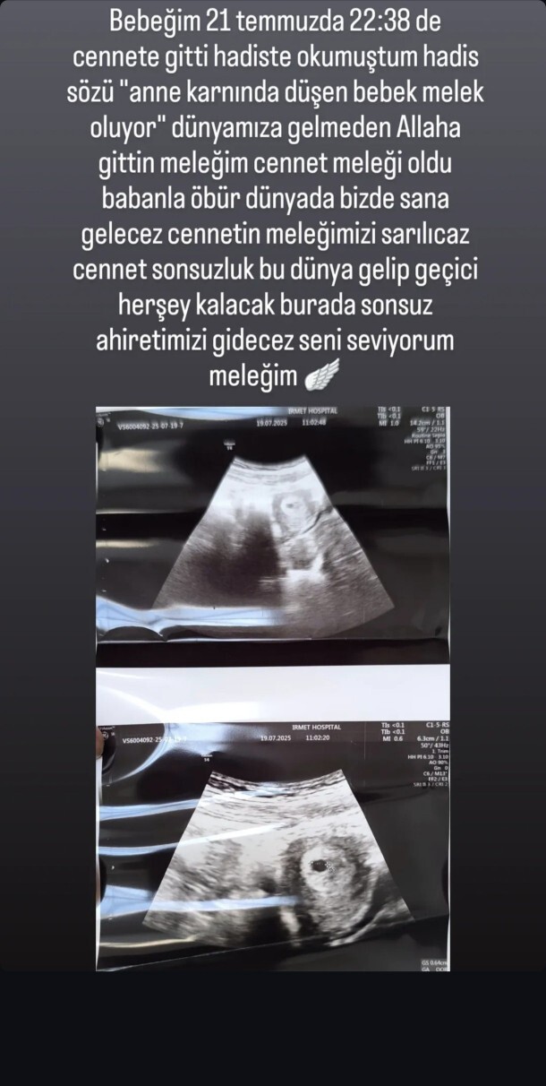 Namazımı kılarken düşük oldu saat 22:38 de 21 temmuzda bebeğim melek oldu öbür dünyada görüşürüz meleğim?