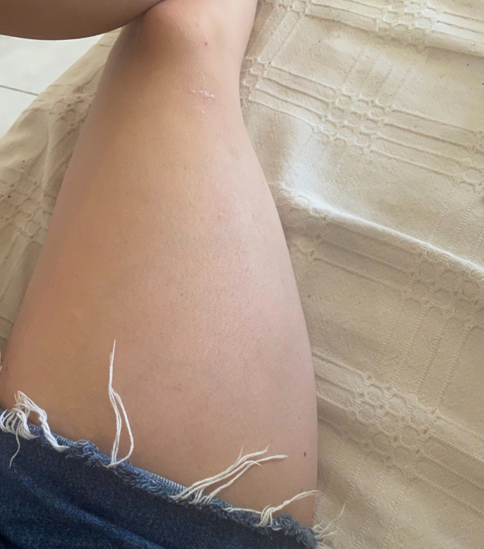 Bacaklarım muazzam kilolu, oysa kilolu değilim nasıl eriteceğin?