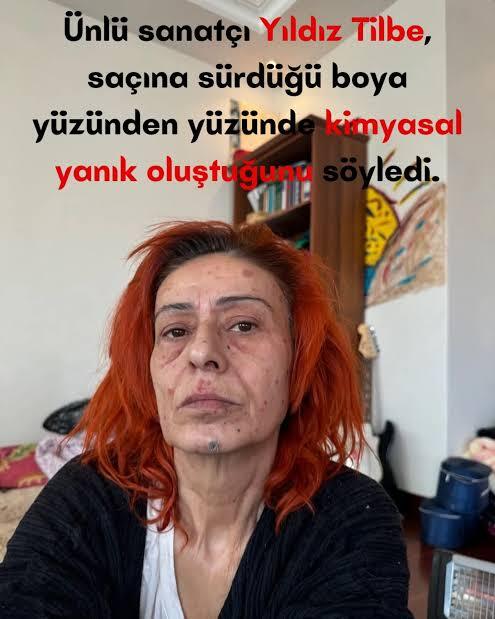 Kızıl saçlı kadınlar seksi gelirmi?