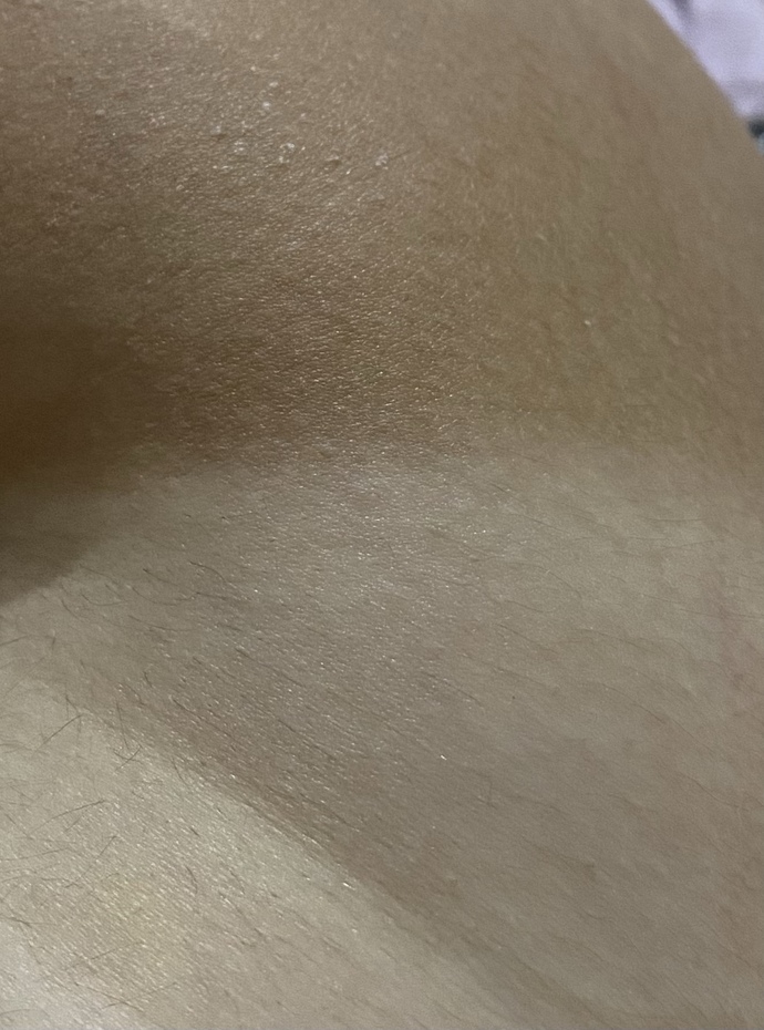 Gunes kremi kullanmama rağmen beyaz tenim esmerlesti ya napicam?