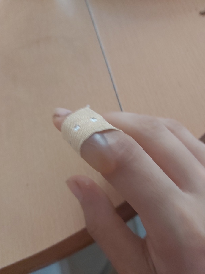 Elimin içi ile sıcak pürmuzün ucunu tuttum elim su toplar mi?