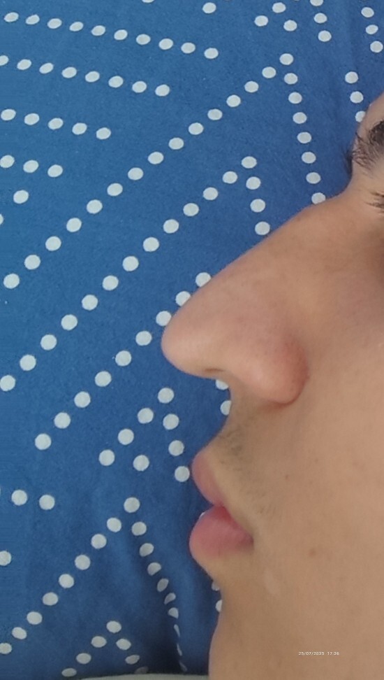 Ameliyat olmalı mıyım?