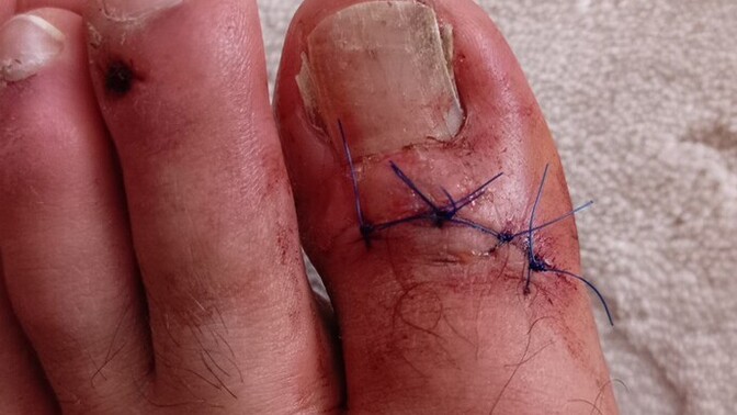 Motorsiklet kazası yapan var mı aranızda?