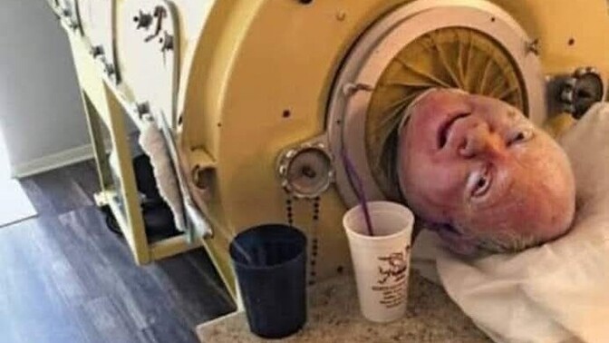 Demir Akciğer makinesinde 70 yıl yaşayan Paul Alexanderı biliyor musunuz?