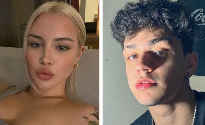 Dudak dolgusu olan biriyle sevgili olur musun?