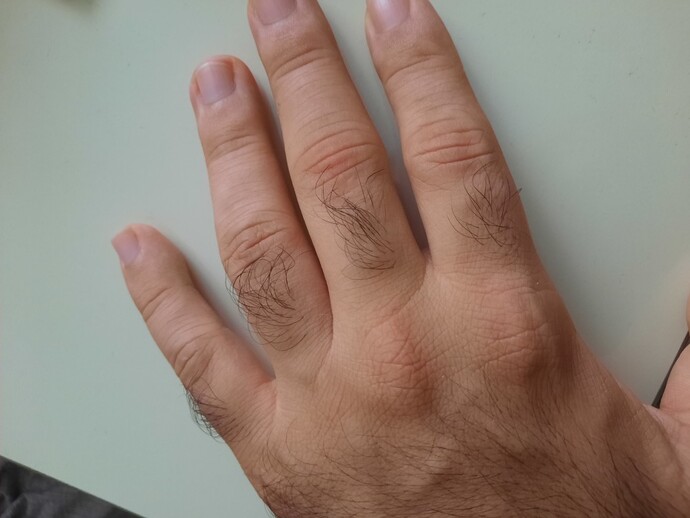 Ellerimdeki bu kılları kesmeli miyim?