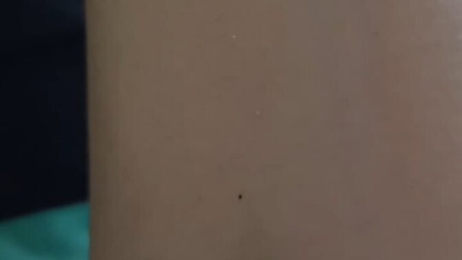 Acil yardıma ihtiyacım var?