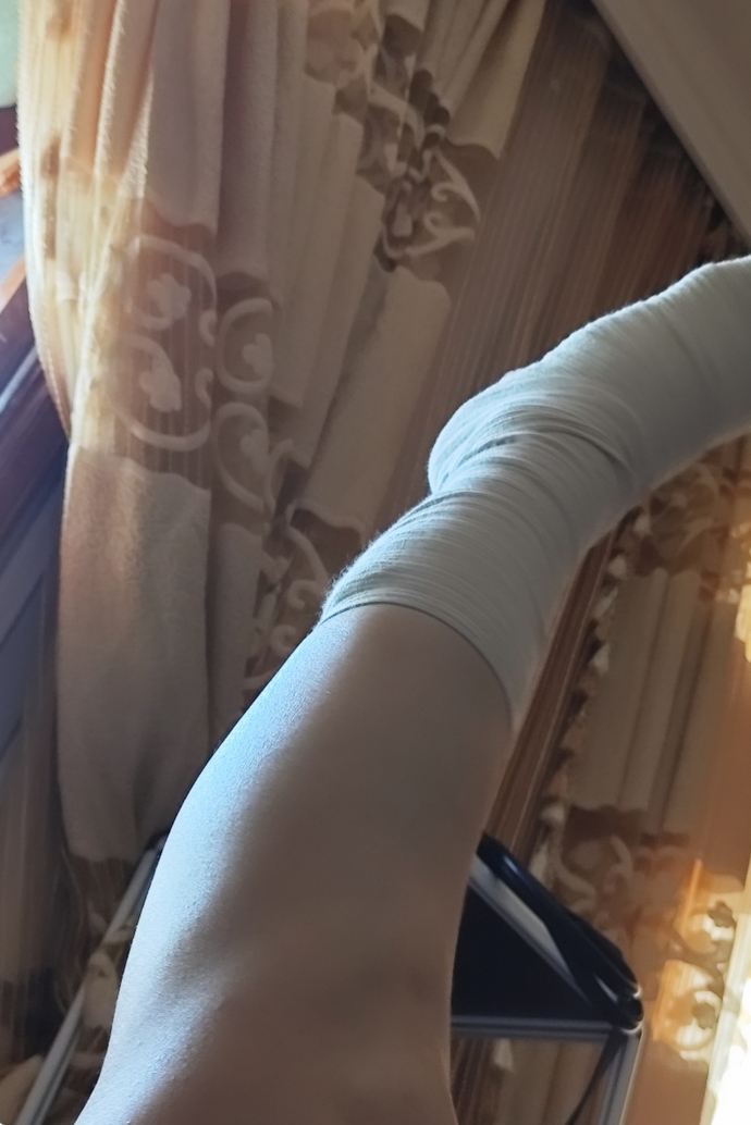 Bizim oğlanla aramız iyi değil ayağım alçıda şöyle bir fotoğrafı hikayeye atarsam sizce merak Edib yazar mı?🤔🤔?