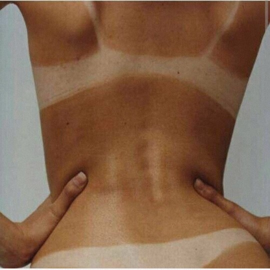 Bikini izi olmadan güneşlenmek mümkün değil mi?