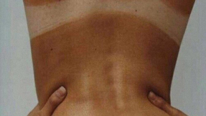 Bikini izi olmadan güneşlenmek mümkün değil mi?