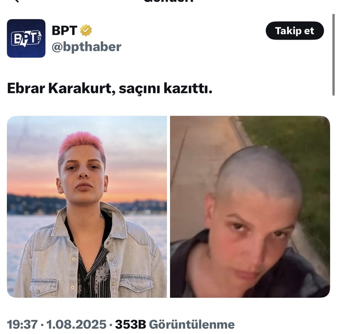 Ebrar karakurt saçını kazıttı, ne düşünüyorsunuz, nasıl olmuş?